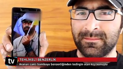 Canlı bombaya benzerliği hayatını kararttı