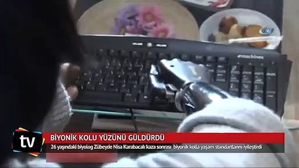 Biyonik kolu yüzünü güldürdü