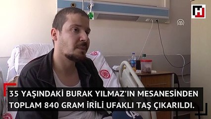 Mesanesinden toplam 840 gram irili ufaklı taş çıkarıldı