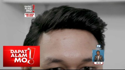 Idinidikit na toupee, sagot sa buhok na napanot? | Dapat Alam Mo!