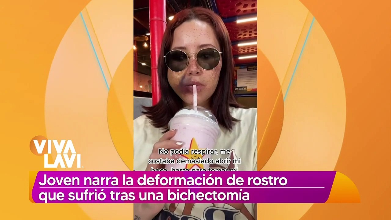 Le deforman rostro a joven tras realizarse bichectomía