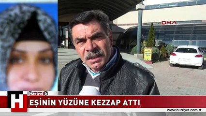 BOŞANMA DAVASI AÇAN EŞİNİN YÜZÜNE KEZZAP ATTI