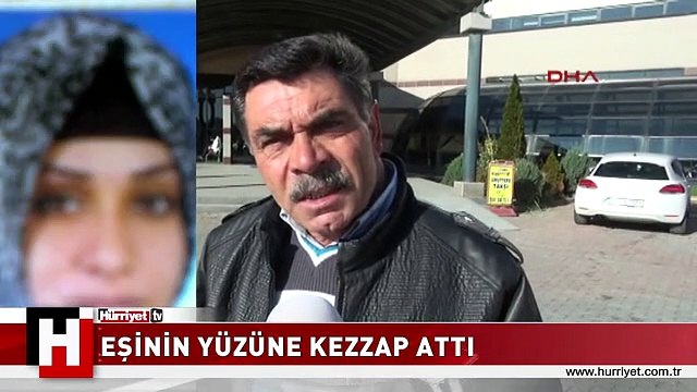 BOŞANMA DAVASI AÇAN EŞİNİN YÜZÜNE KEZZAP ATTI