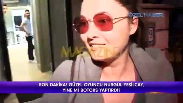 Nurgül Yeşilçay yine mi estetik yaptırdı?