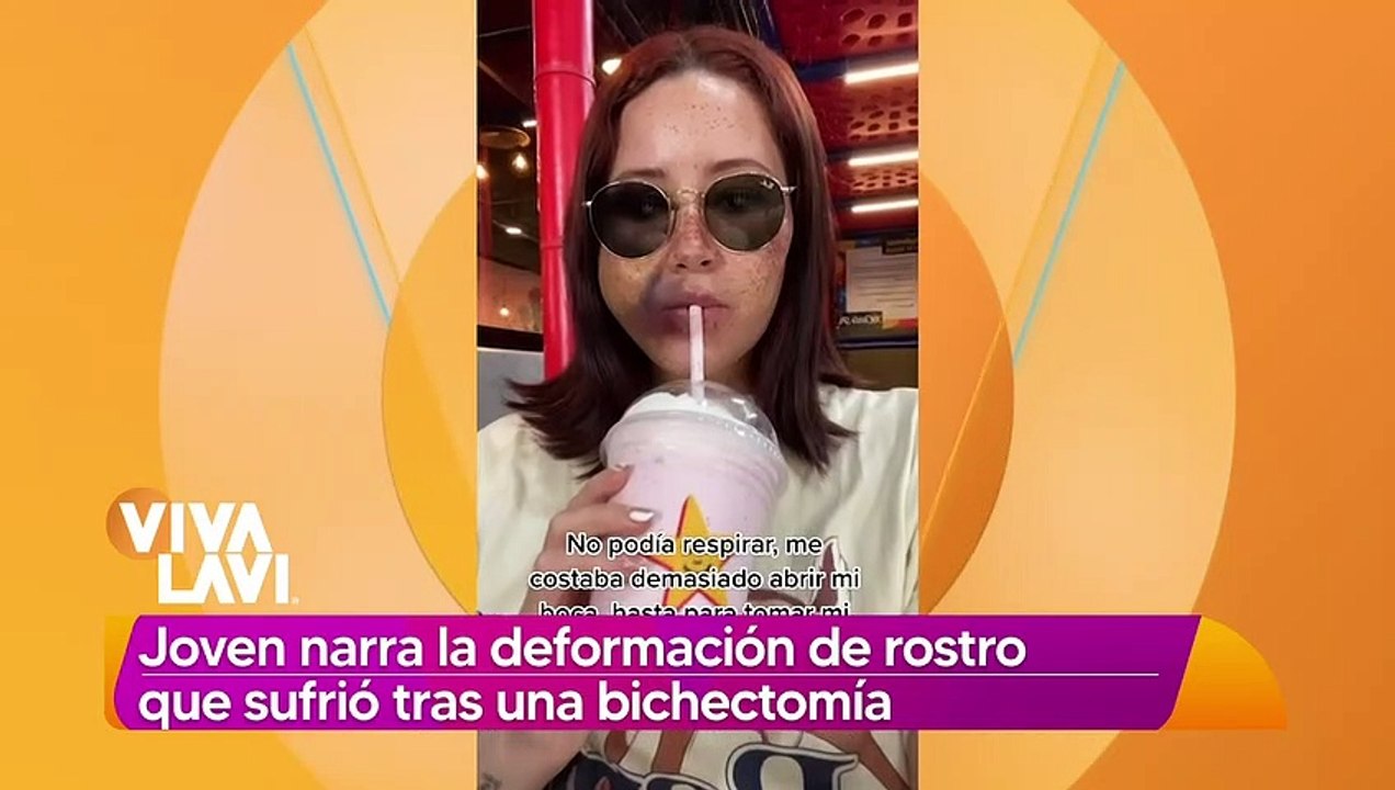 Le deforman rostro a joven tras realizarse bichectomía