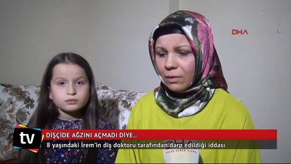 8 yaşındaki İrem’in diş doktoru tarafından darp edildiği iddası