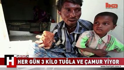 Her gün 3 kilo tuğla ve çamur yiyor