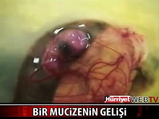 BUNU GÖRMÜŞ MÜYDÜNÜZ