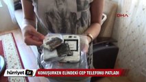 Konuşurken elindeki cep telefonu patladı