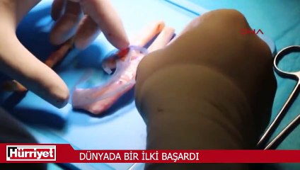 Anneden alınan kaburga kemikleriyle oğluna kulak