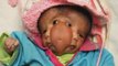 Baby born with four eyes, two mouths and two faces