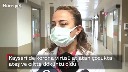 Kayseri’de korona virüsü atlatan çocukta ateş ve ciltte döküntü oldu