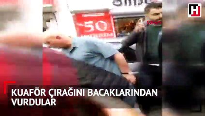 Kuaför çırağını bacaklarından vurdular