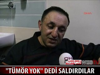 TÜMÖR YOK MÜJDESİ VERDİ DAYAK YEDİ