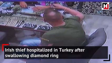 Irish thief hospitalized in Turkey after swallowing diamond ring