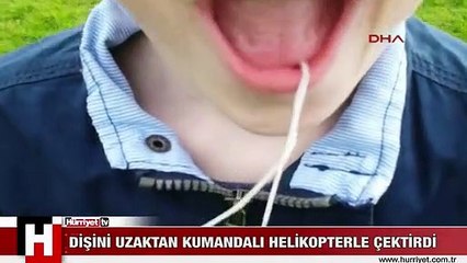 Sallanan dişini uzaktan kumandalı helikopterle çektirdi