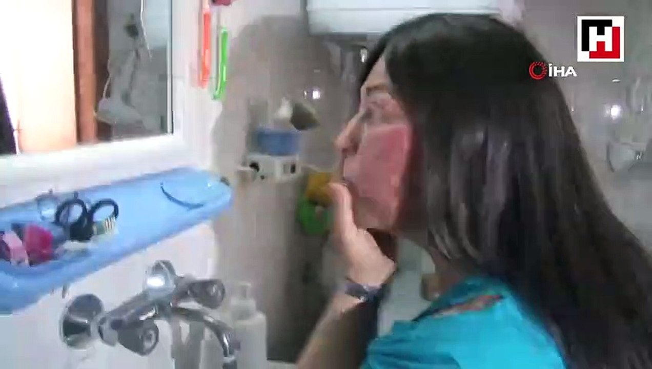 Yıllara sonra suyla barıştı, güneşle barışamadı.