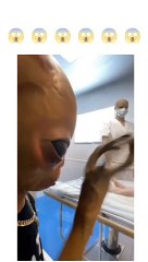 Alien opration in the hospital of city and catch in camera