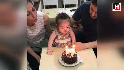 Down sendromlu bebeğin doğum günü sevinci