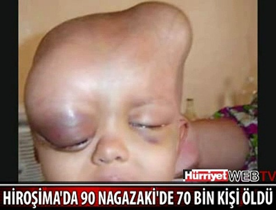 NAZIM HİKMET'İN SESİNDEN HİROŞİMA