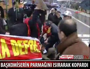 BAŞKOMİSERİN PARMAĞINI KOPARTTI