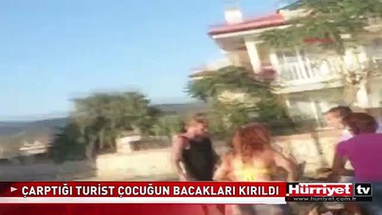 EHLİYETSİZ SÜRÜCÜNÜN ÇARPTIĞI TURİST ÇOCUĞUN BACAKLARI KIRILDI