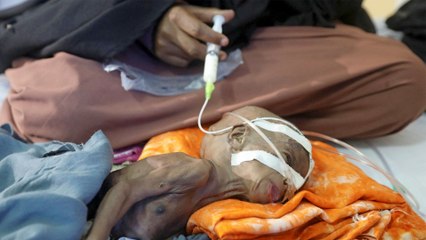 لعنة الجوع في الصومال.. الأمم المتحدة تحذر من خطر المجاعة على ملايين الأطفال
