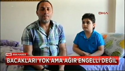 İki bacağı olmamasına rağmen engelli maaşını kestiler