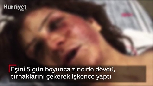 Eşini 5 gün boyunca zincirle dövdü, tırnaklarını çekerek işkence yaptı