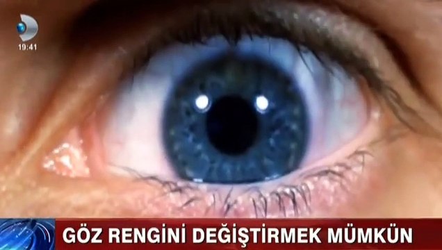 Göz rengini değiştirmek artık mümkün!