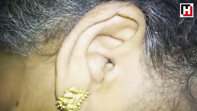 Kulağından çıkanı görünce kimse gözlerine inanamadı!