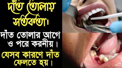 দাঁত তোলার আগে ও পরে করণীয় - যেসব কারণে দাঁত তুলতে হয় - দাঁত তোলার পর করণীয় - Dat tolar por ki korte hoy.