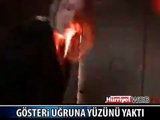 KIZIN YÜZÜ YANDI
