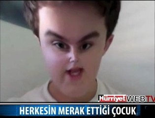 HERKESİN MERAK ETTİĞİ ÇOCUK