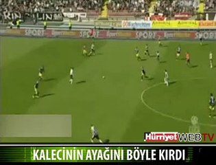 KALECİNİN AYAĞI BÖYLE KIRILDI