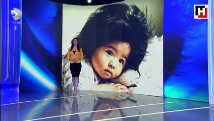 Dünya bu bebeği konuşuyor