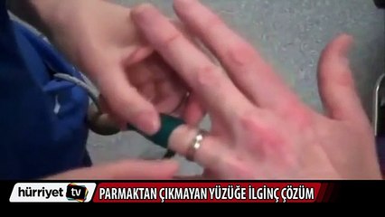Parmağa sıkışan yüzük nasıl çıkar? İşte yöntemi!
