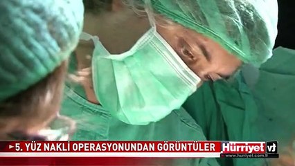5. YÜZ NAKLİ OPERASYONUNDAN GÖRÜNTÜLER