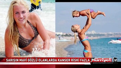 GÜNEŞLE GELEN BÜYÜK TEHLİKE! SARIŞIN MAVİ GÖZLÜLERDE KANSER RİSKİ FAZLA