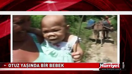 İŞTE OTUZ YAŞINDA OLAN ANCAK 9 AYLIK GÖRÜNEN O KADIN