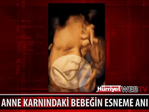 ANNE KARNINDAKİ BEBEĞİN ESNEMESİ GÖRÜNTÜLENDİ