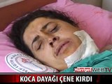 KOCASI ÇENESİNİ KIRDI