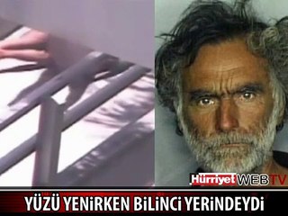 YAMYAM YÜZÜNÜ YERKEN KURBANIN BİLİNCİ YERİNDEYDİ