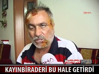 ONU KAYINBİRADERİ BU HALE GETİRDİ
