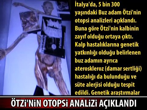 5300 YILLIK KALP ZAYIF ÇIKTI