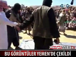 TÜYLER ÜRPERTEN GÖRÜNTÜ