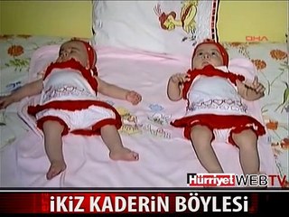 İKİZ KADERİN BÖYLESİ