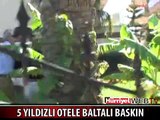 5 YILDIZLI OTELE BALTALI BASKIN