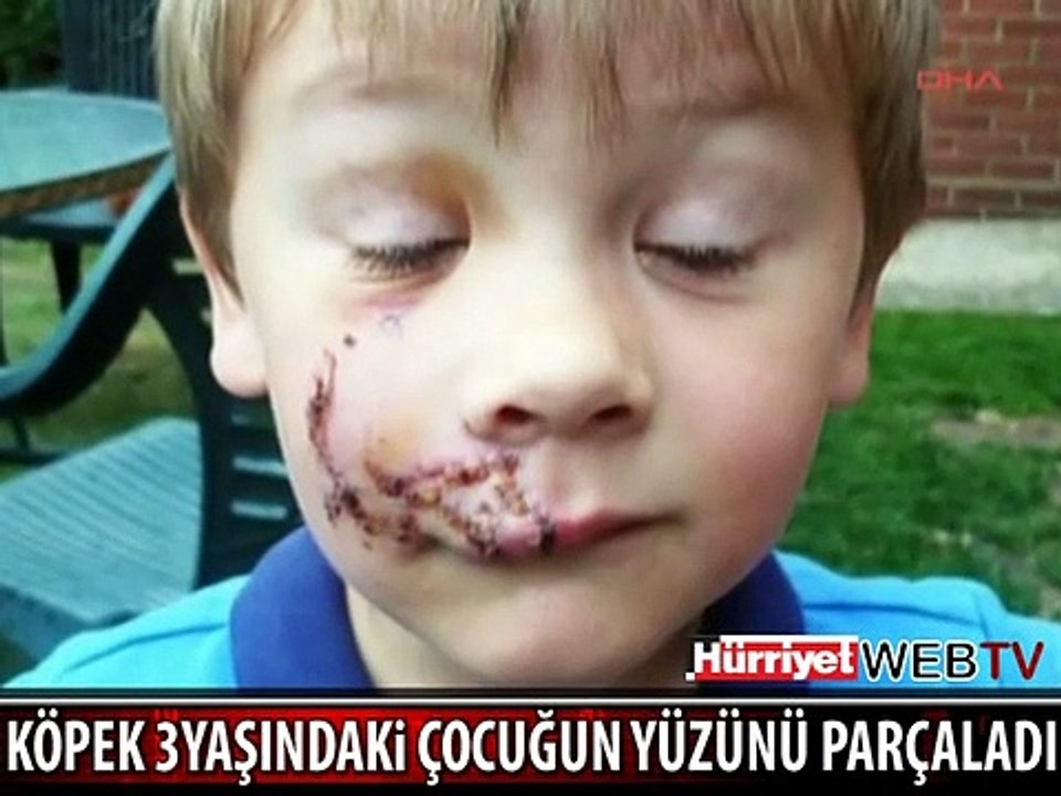 KÖPEK DEHŞETİ