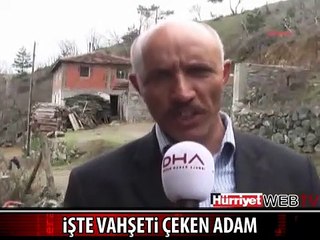 KÖPEK VAHŞETİNİ ÇEKEN ADAM KONUŞTU